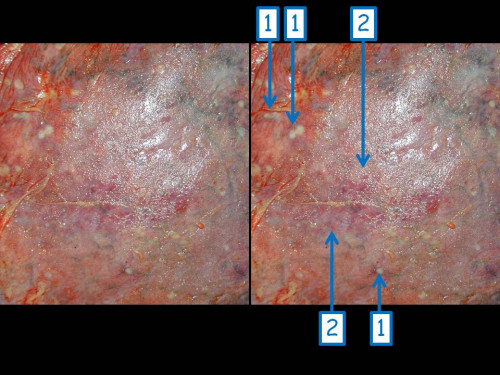 Makroskopie - Organausschnitt nummeriert