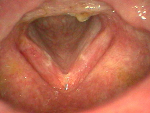 Makroskopie - Untersuchung Respiration