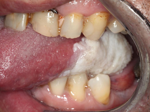 Makroskopie - präoperativ