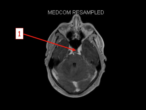 Bildgebung - MRT nummeriert