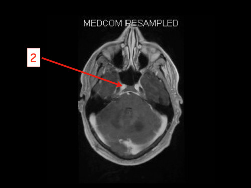 Bildgebung - MRT nummeriert