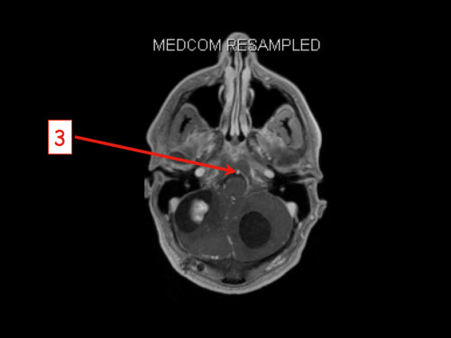 Bildgebung - MRT nummeriert
