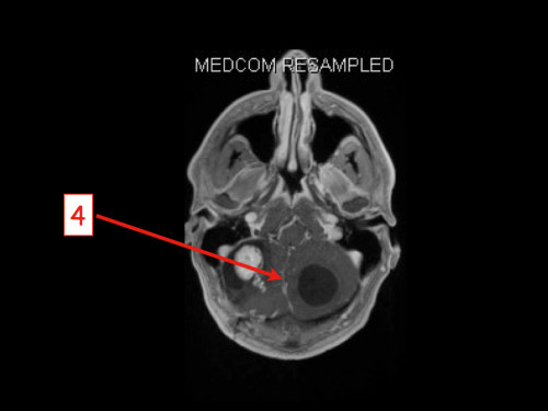 Bildgebung - MRT nummeriert