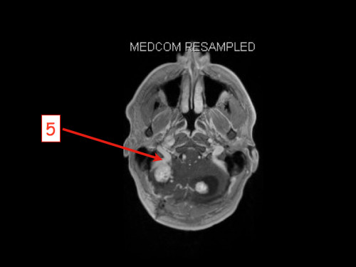 Bildgebung - MRT nummeriert