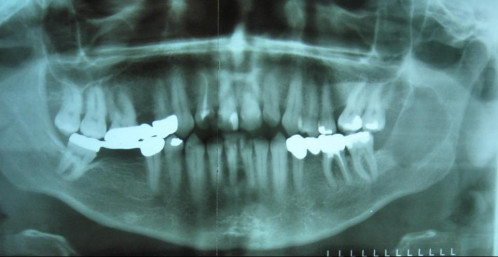 Bildgebung - OPAN präoperativ
