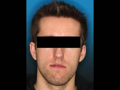 Makroskopie - extraoral