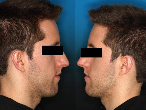 Makroskopie - extraoral