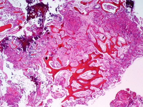 Mikroskopie - Knochen