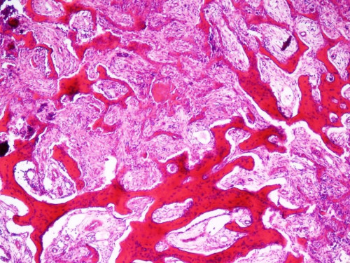 Mikroskopie - Knochen