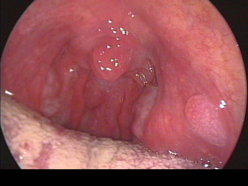 Makroskopie - Mundhöhle