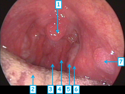 Makroskopie - Mundhöhle nummeriert