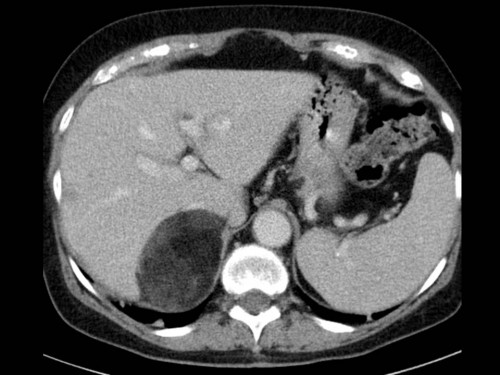 Bildgebung - Schnittbild