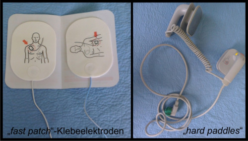 Makroskopie  - Defibrillationselektroden