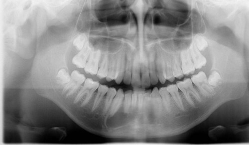 Bildgebung - OPAN präoperativ