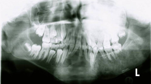 Bildgebung - OPAN 2004