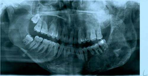 Bildgebung - OPAN 2011