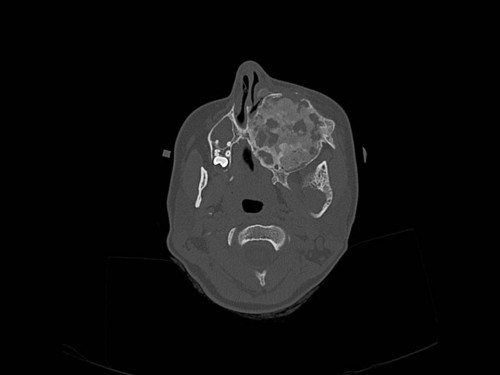 Bildgebung - CT axial präoperativ