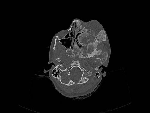 Bildgebung - CT axial präoperativ