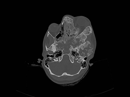 Bildgebung - CT axial präoperativ