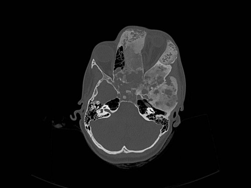 Bildgebung - CT axial präoperativ