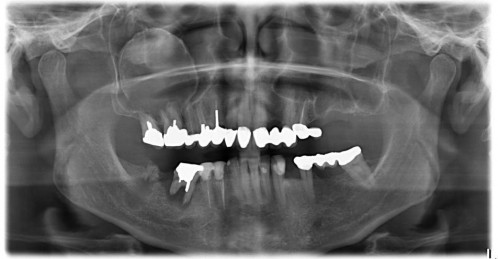 Bildgebung - OPAN präoperativ