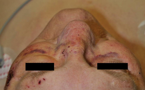 Makroskopie - präoperativ