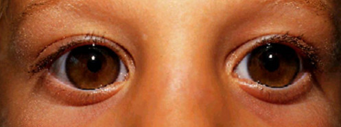 Makroskopie - Gesicht