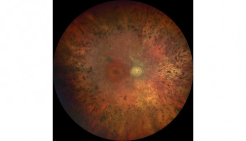 Licht am Ende des Tunnels_1