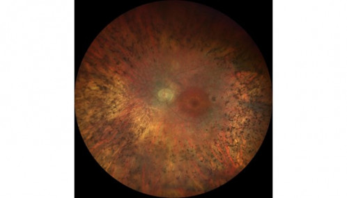 Licht am Ende des Tunnels_2