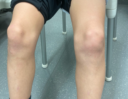 Inspektion Knie im Seitenvergleich