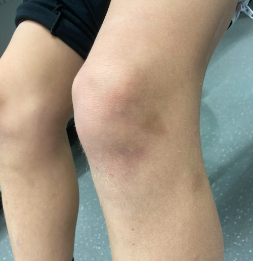 Inspektion linkes Knie