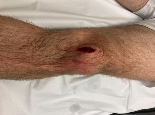 Inspektion linkes Bein