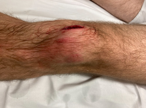 Inspektion linkes Bein