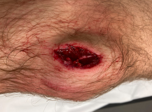 Inspektion linkes Bein