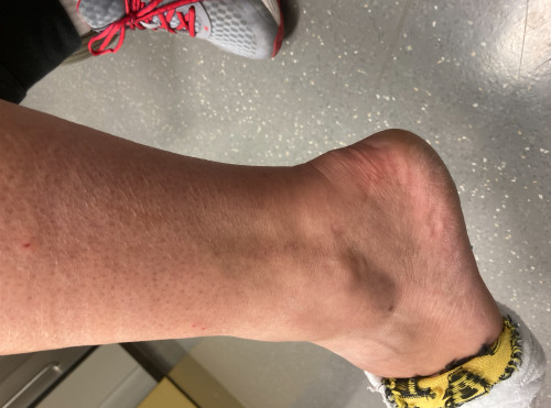 Inspektion Bein links 2