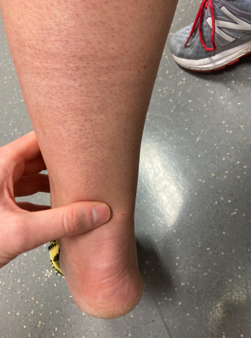 Inspektion Bein links 3