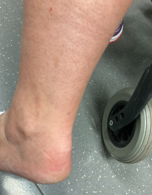 Inspektion Bein links 4