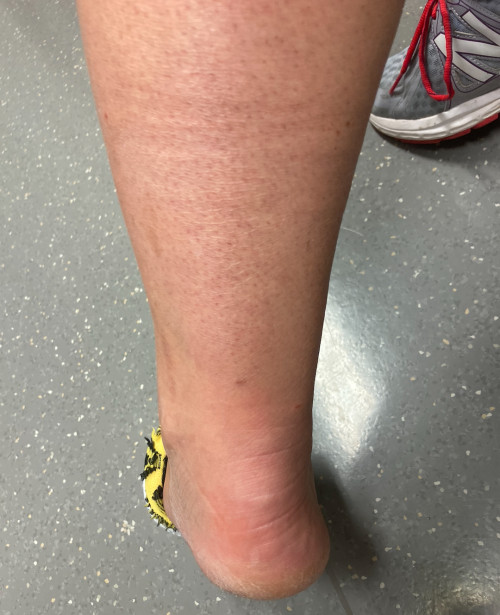 Inspektion Bein links 5