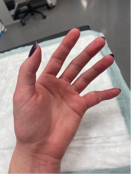 Inspektionsbefund Hand links