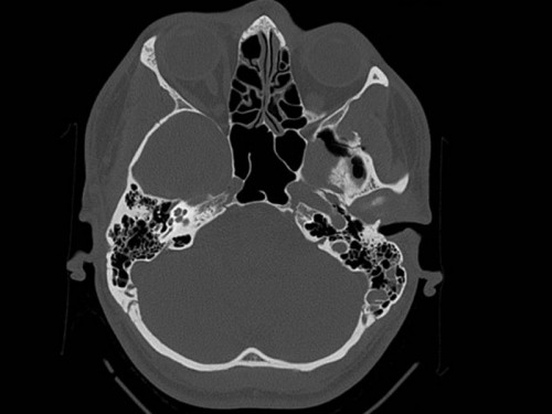 Bildgebung - CT Schädel