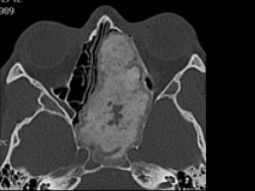 Bildgebung - CT axial