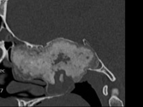Bildgebung - CT sagittal