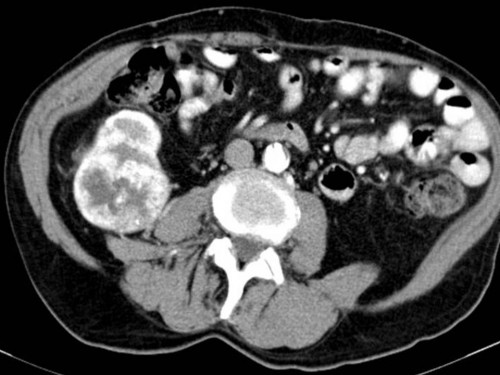 Bildgebung - Axiales Schichtbild