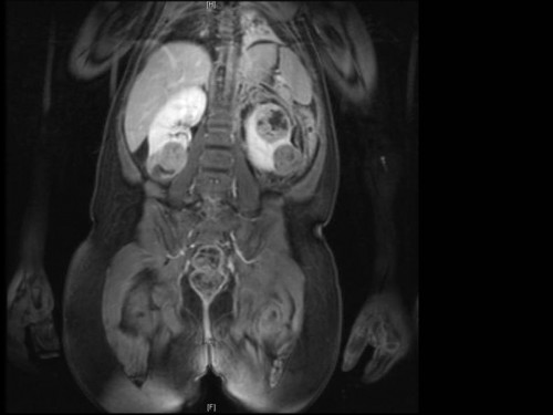 Bildgebung - frontal