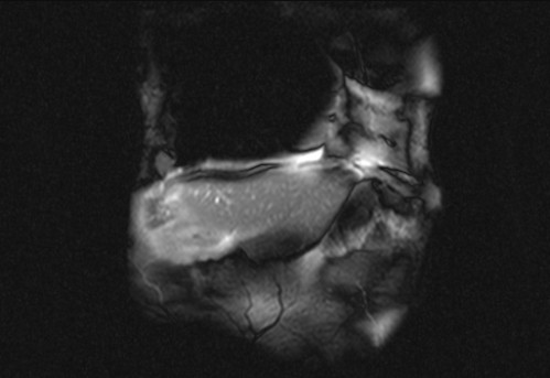 Bildgebung - koronar