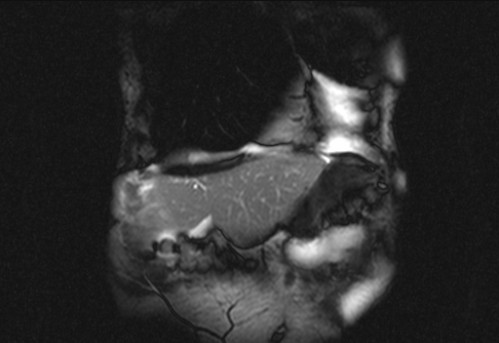 Bildgebung - koronar