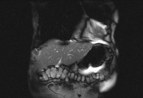 Bildgebung - koronar