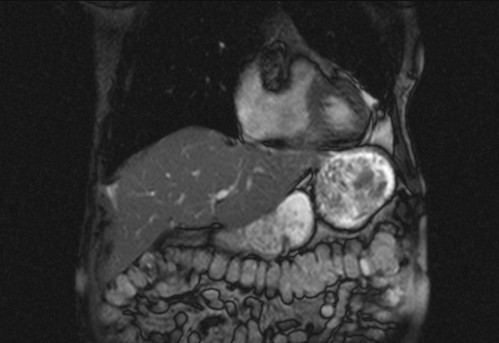 Bildgebung - koronar