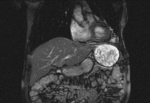 Bildgebung - koronar