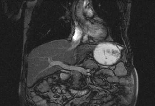 Bildgebung - koronar